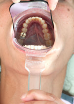 Charger l&#39;image dans la galerie, ECRAN OCCLUSAL K&amp;K
