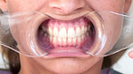 Cargar imagen en el visor de la galería, OCCLUSAL STANDARD - lip and cheek retractor
