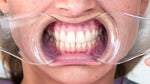 Load image into Gallery viewer, OCCLUSAL STANDARD - lip and cheek retractor
