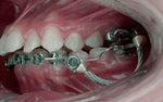 Charger l&#39;image dans la galerie, MAXEE - double ended retractor
