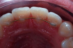 Charger l&#39;image dans la galerie, ECRAN OCCLUSAL K&amp;K
