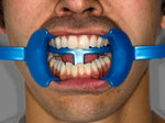 Charger l&#39;image dans la galerie, TCL - self-retaining retractor
